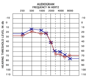 Audiogram Testing – Hearing Health Mississippi